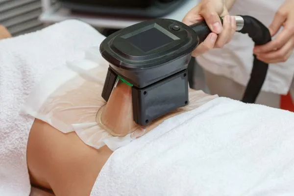 Image of person having fat freezing treatment to help weight gain West Bromwich
