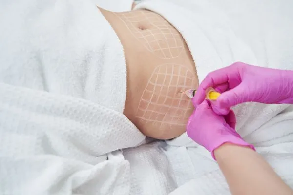 image of fat dissolving injections on love handles to help combat weight gain West Bromwich