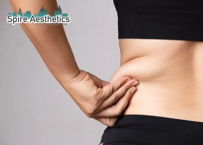 Image of woman pinching fat on their hips West Bromwich. Fat Freezing treatment