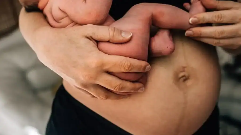 Why Is My Stomach Still Big After Pregnancy West Bromwich?